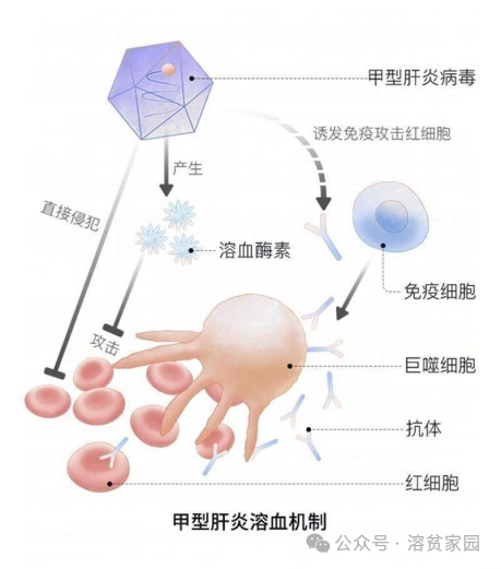 认识疾病 | 感染性溶血性贫血